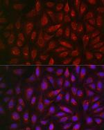 ALDH2 Antibody in Immunocytochemistry (ICC/IF)