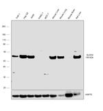 ALDH2 Antibody in Western Blot (WB)