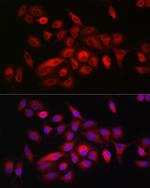 CD55 Antibody in Immunocytochemistry (ICC/IF)