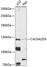 CACNA2D4 Antibody in Western Blot (WB)