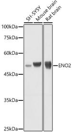 NSE Antibody in Western Blot (WB)