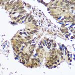 UBE1 Antibody in Immunohistochemistry (Paraffin) (IHC (P))