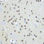 UBE1 Antibody in Immunohistochemistry (Paraffin) (IHC (P))