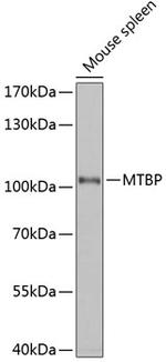 MTBP Antibody in Western Blot (WB)