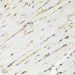 Annexin A2 Antibody in Immunohistochemistry (Paraffin) (IHC (P))