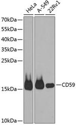 CD59 Antibody in Western Blot (WB)