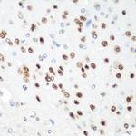 CDK1 Antibody in Immunohistochemistry (Paraffin) (IHC (P))