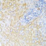 CDK1 Antibody in Immunohistochemistry (Paraffin) (IHC (P))