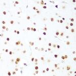 CDK1 Antibody in Immunohistochemistry (Paraffin) (IHC (P))