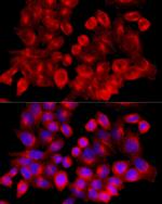 Clathrin Heavy Chain Antibody in Immunocytochemistry (ICC/IF)