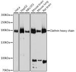 Clathrin Heavy Chain Antibody in Western Blot (WB)