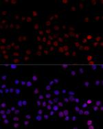 hnRNP L Antibody in Immunocytochemistry (ICC/IF)