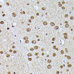 hnRNP L Antibody in Immunohistochemistry (Paraffin) (IHC (P))