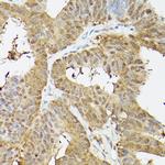 PSMA3 Antibody in Immunohistochemistry (Paraffin) (IHC (P))