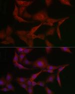 MSRA Antibody in Immunocytochemistry (ICC/IF)