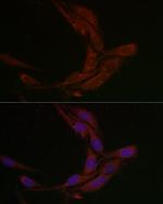 MSRA Antibody in Immunocytochemistry (ICC/IF)