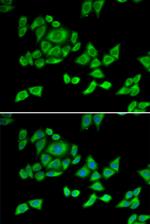 OGDH Antibody in Immunocytochemistry (ICC/IF)