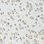 OGDH Antibody in Immunohistochemistry (Paraffin) (IHC (P))