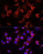 alpha-1 Antitrypsin Antibody in Immunocytochemistry (ICC/IF)