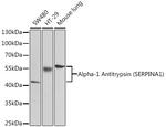 alpha-1 Antitrypsin Antibody in Western Blot (WB)