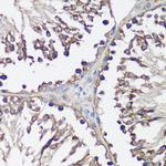 VAMP2 Antibody in Immunohistochemistry (Paraffin) (IHC (P))