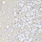 VAMP2 Antibody in Immunohistochemistry (Paraffin) (IHC (P))