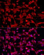 PEX5 Antibody in Immunocytochemistry (ICC/IF)