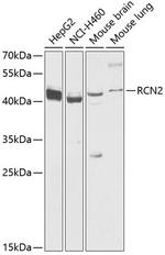 RCN2 Antibody in Western Blot (WB)