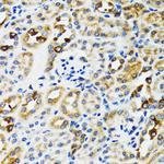 Ribophorin I Antibody in Immunohistochemistry (Paraffin) (IHC (P))