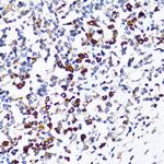 Ribophorin I Antibody in Immunohistochemistry (Paraffin) (IHC (P))