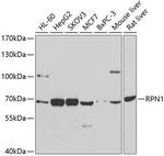 Ribophorin I Antibody in Western Blot (WB)