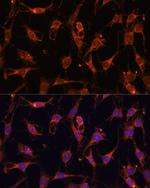 AKT2 Antibody in Immunocytochemistry (ICC/IF)