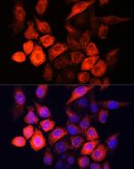 SHH Antibody in Immunocytochemistry (ICC/IF)