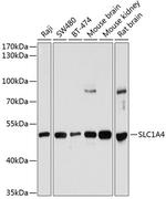 SLC1A4 Antibody in Western Blot (WB)