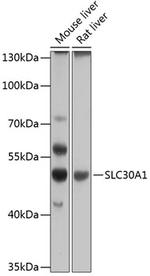 SLC30A1 Antibody in Western Blot (WB)