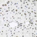 HDAC3 Antibody in Immunohistochemistry (Paraffin) (IHC (P))