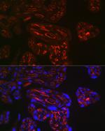 CD32b Antibody in Immunohistochemistry (Paraffin) (IHC (P))