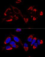 UCRC Antibody in Immunocytochemistry (ICC/IF)