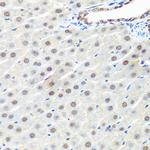 PRP19 Antibody in Immunohistochemistry (Paraffin) (IHC (P))