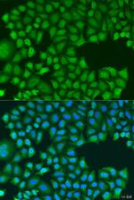 TIRAP Antibody in Immunocytochemistry (ICC/IF)