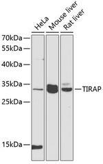 TIRAP Antibody in Western Blot (WB)