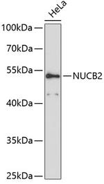 NUCB2 Antibody in Western Blot (WB)