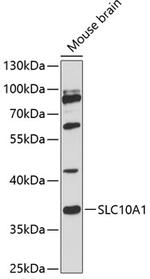 NTCP Antibody in Western Blot (WB)