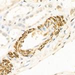 WNT5A Antibody in Immunohistochemistry (Paraffin) (IHC (P))