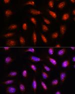 COPS8 Antibody in Immunocytochemistry (ICC/IF)