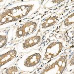 FZD5 Antibody in Immunohistochemistry (Paraffin) (IHC (P))