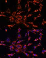 ITPR3 Antibody in Immunocytochemistry (ICC/IF)