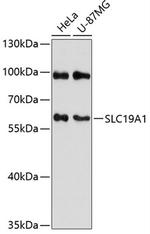 SLC19A1 Antibody in Western Blot (WB)