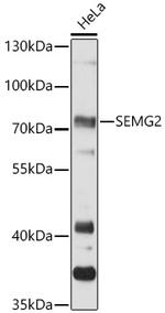 SEMG2 Antibody in Western Blot (WB)