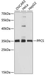 PPCS Antibody in Western Blot (WB)